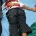 کنی پورہ سری نگرمیں طلباء کے 2 گروپوں میں جھگڑا،2طالب علم چاقو کے وار سے زخمی